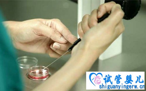 做试管婴儿前的准备