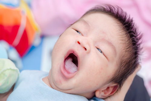 试管婴儿和人工授精应该哪一个 