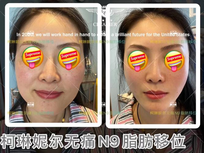 泰国高龄试管婴儿医院技术优势及排名一览 附