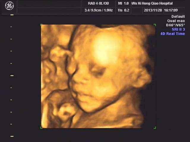 泰国三代试管婴儿技术费用大约多少钱 