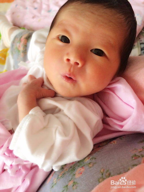 脚踝扭伤了肿了怎么恢复最快