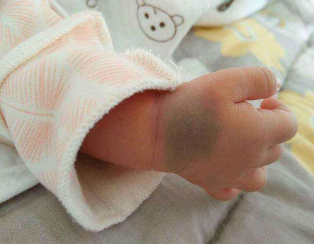 泰国三代试管婴儿年龄越大费用越高吗