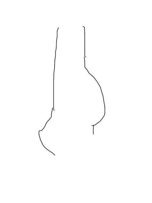 美国三代试管婴儿费用是怎样的