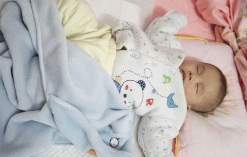 怎样改善过敏体质