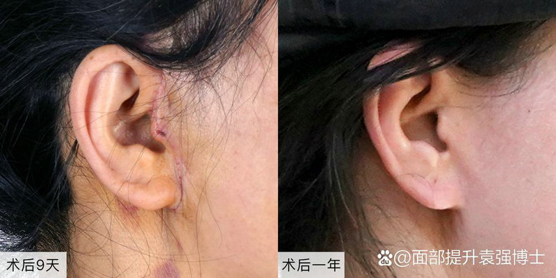 宝宝吃的苹果泥需要蒸多久（婴儿吃苹果泥要蒸多久）