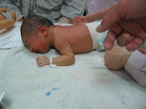 假疣和真疣的区别图