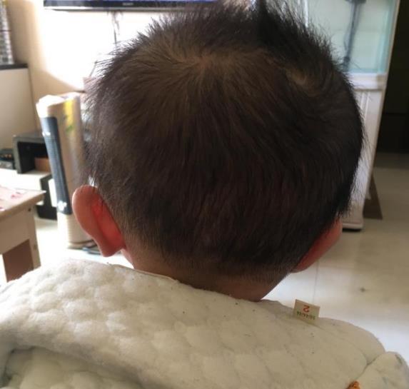 泰国三代试管婴儿怎么选对哪一家更值得 