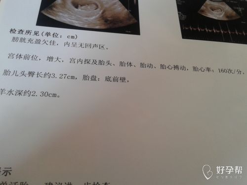 做一次试管婴儿成功几率有多大 