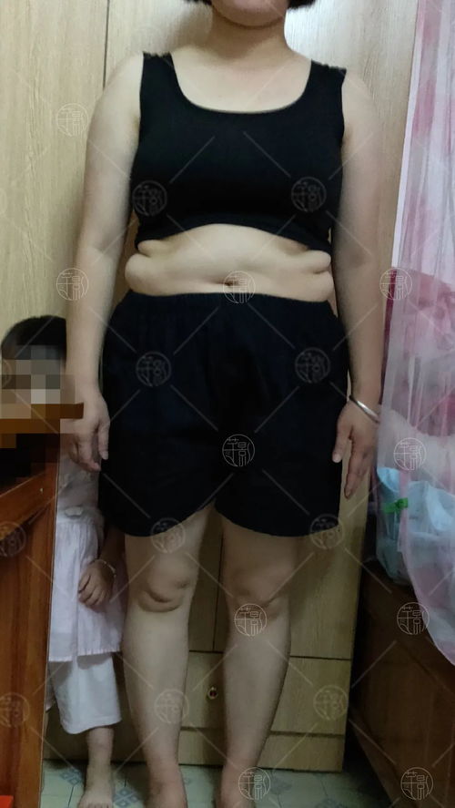 如何预防婴儿湿疹