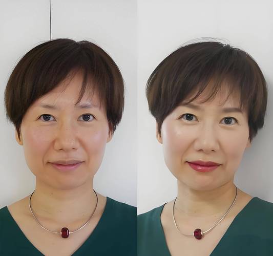 泰国三代试管婴儿费用表 帮你节省开支 实现生育梦想