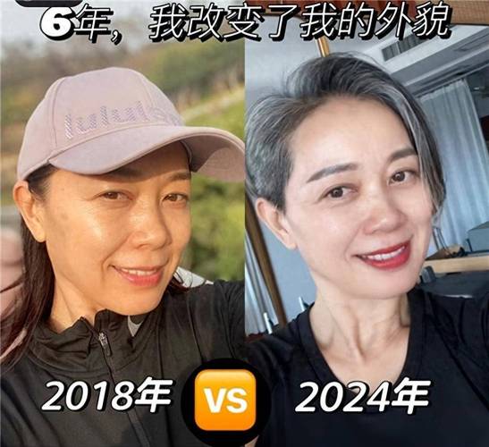 婴儿嘴唇起湿疹怎么办