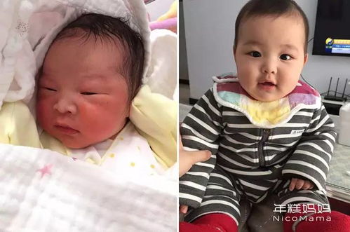 新生儿感染性腹泻的症状及治疗