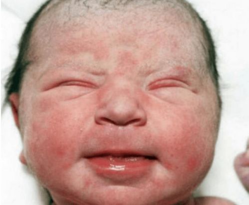 去美国做试管婴儿合法选性别吗