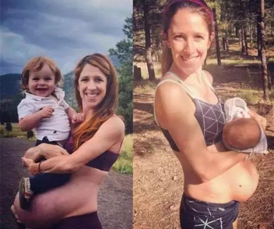 试管婴儿hcg 试管婴儿hcg标准值 试管婴儿hcg低怎么办 试管婴儿注射hcg有什么作用