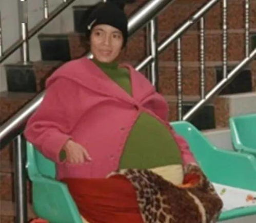 儿童眼睛散光怎么办才能恢复