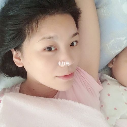 婴儿被蚊子咬了肿得厉害怎么办