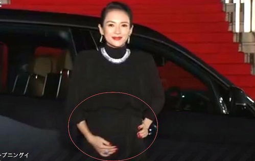 泰国试管婴儿技术全览 先进与领先